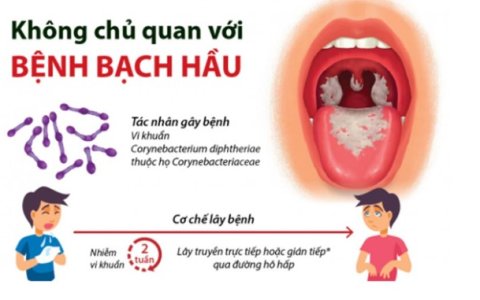 Phòng chống bệnh bạch hầu